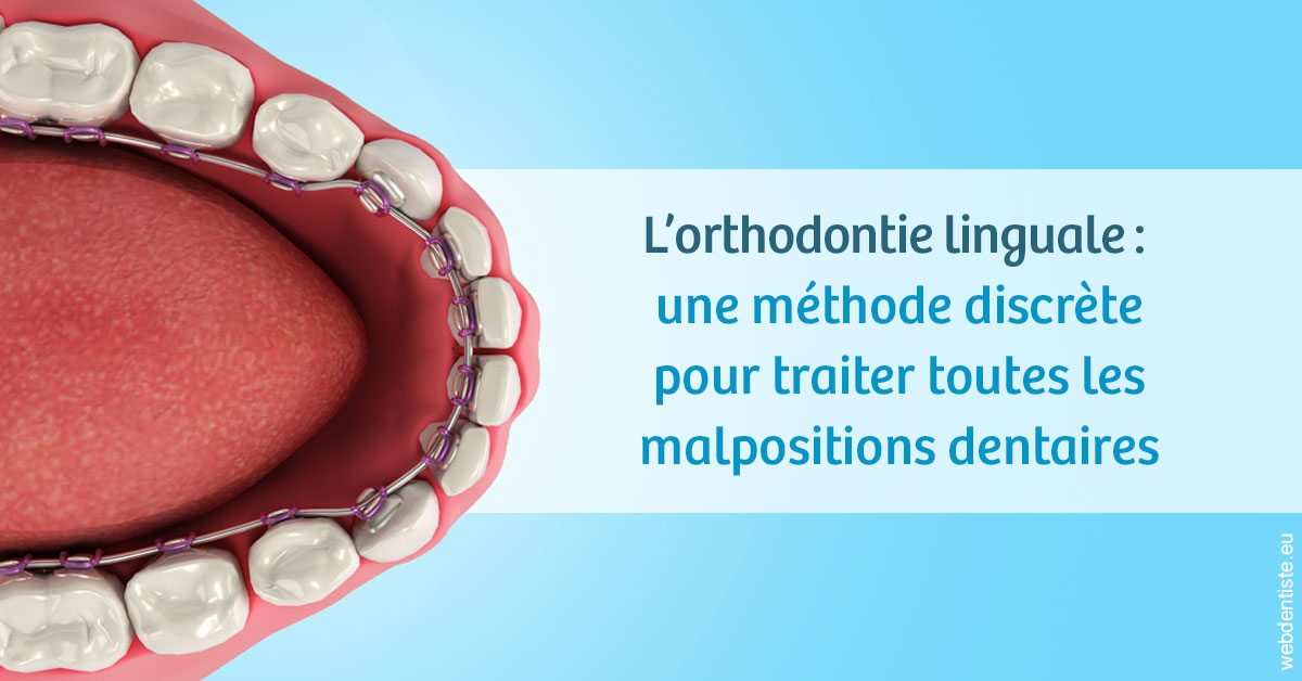 https://selarl-orthodontie-naborienne.chirurgiens-dentistes.fr/L'orthodontie linguale 1