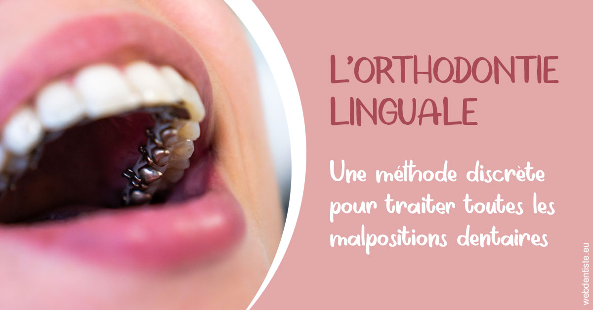 https://selarl-orthodontie-naborienne.chirurgiens-dentistes.fr/L'orthodontie linguale 2