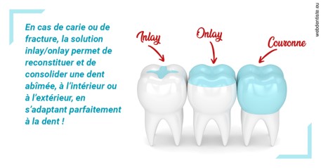 https://selarl-orthodontie-naborienne.chirurgiens-dentistes.fr/L'INLAY ou l'ONLAY