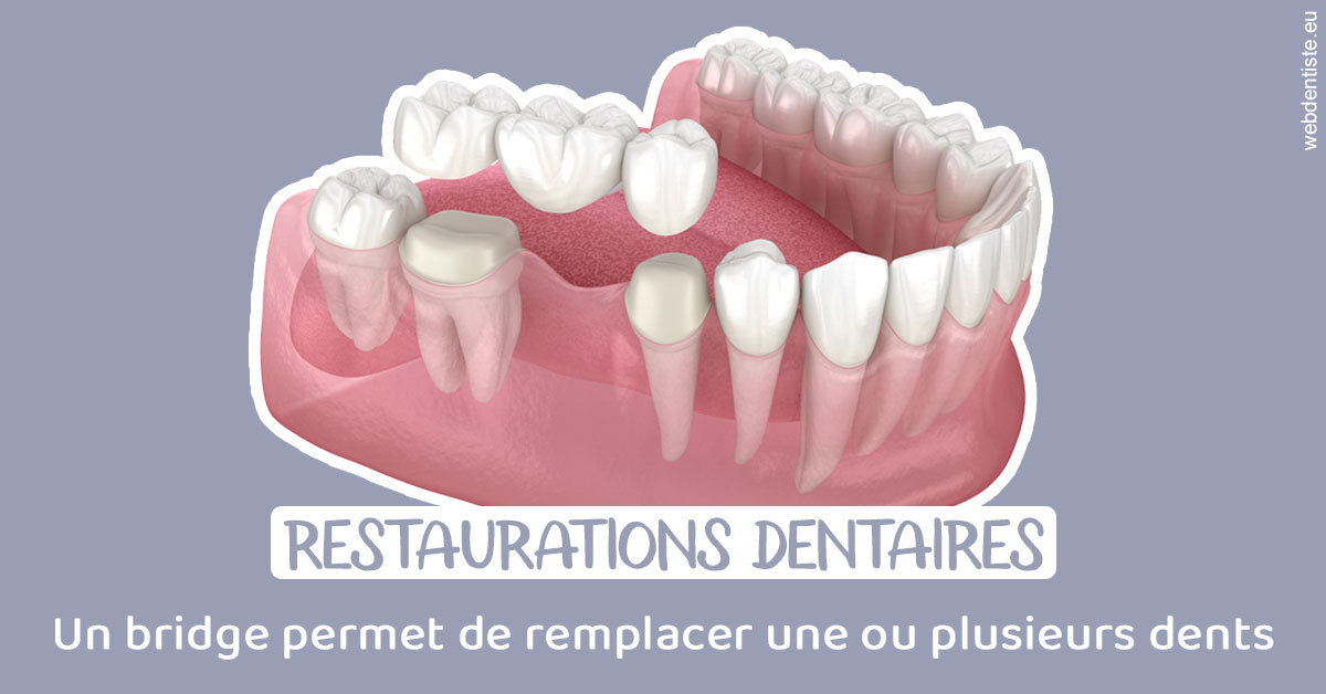 https://selarl-orthodontie-naborienne.chirurgiens-dentistes.fr/Bridge remplacer dents 1