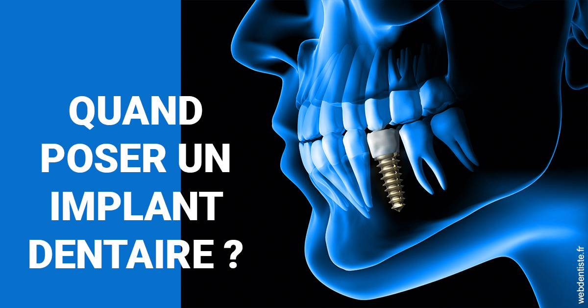 https://selarl-orthodontie-naborienne.chirurgiens-dentistes.fr/Les implants 1