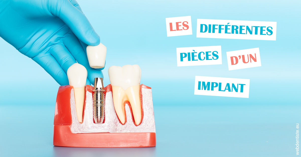 https://selarl-orthodontie-naborienne.chirurgiens-dentistes.fr/Les différentes pièces d’un implant 2