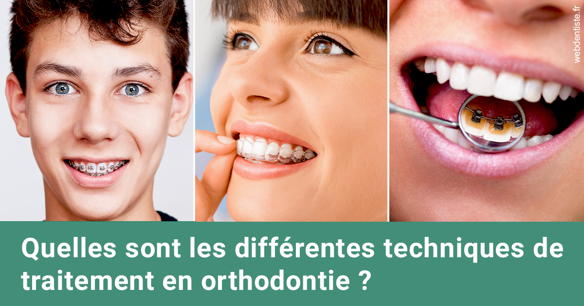 https://selarl-orthodontie-naborienne.chirurgiens-dentistes.fr/Les différentes techniques de traitement 2