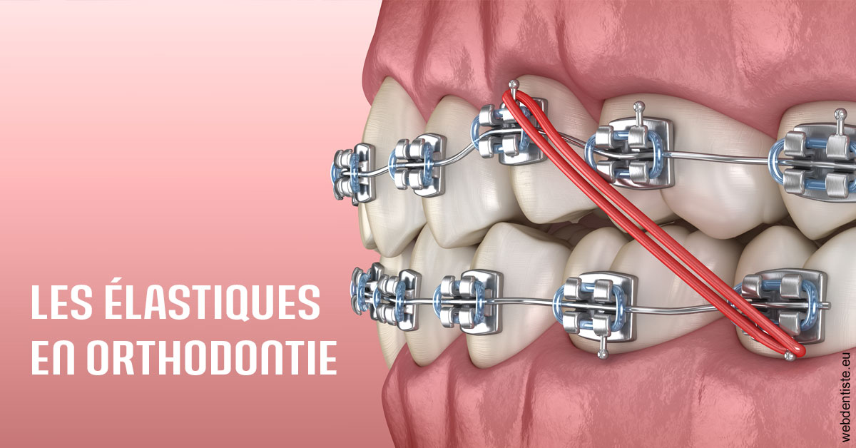https://selarl-orthodontie-naborienne.chirurgiens-dentistes.fr/Elastiques orthodontie 2