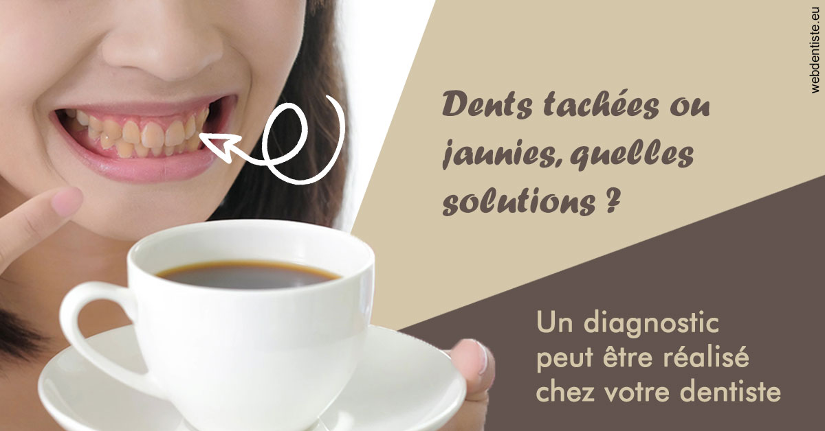 https://selarl-orthodontie-naborienne.chirurgiens-dentistes.fr/Dents tachées 1