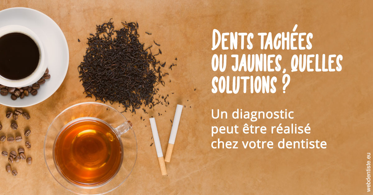 https://selarl-orthodontie-naborienne.chirurgiens-dentistes.fr/Dents tachées 2