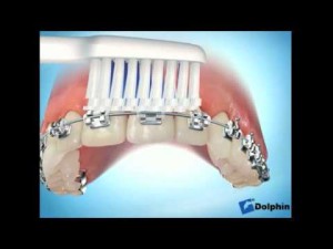Brossage des dents avec des brackets